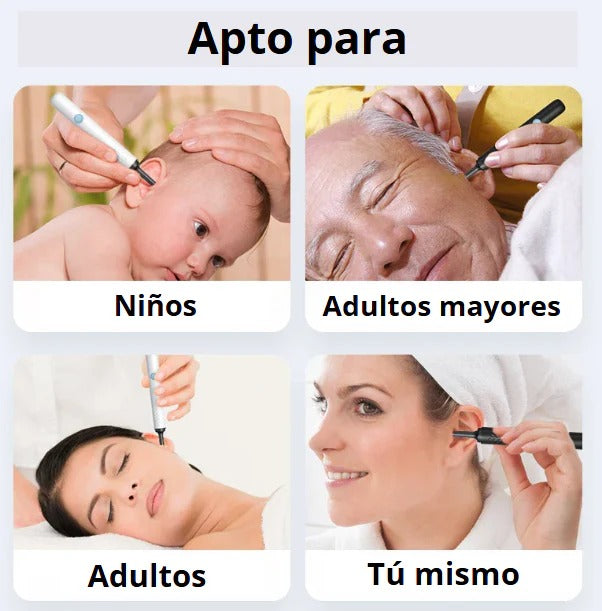 CleanEar - El nuevo método para la limpieza de oídos camara 4K con IA