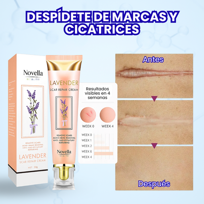 Novella® Crema reparadora de cicatrices de lavanda - Fórmula clínicamente probada
