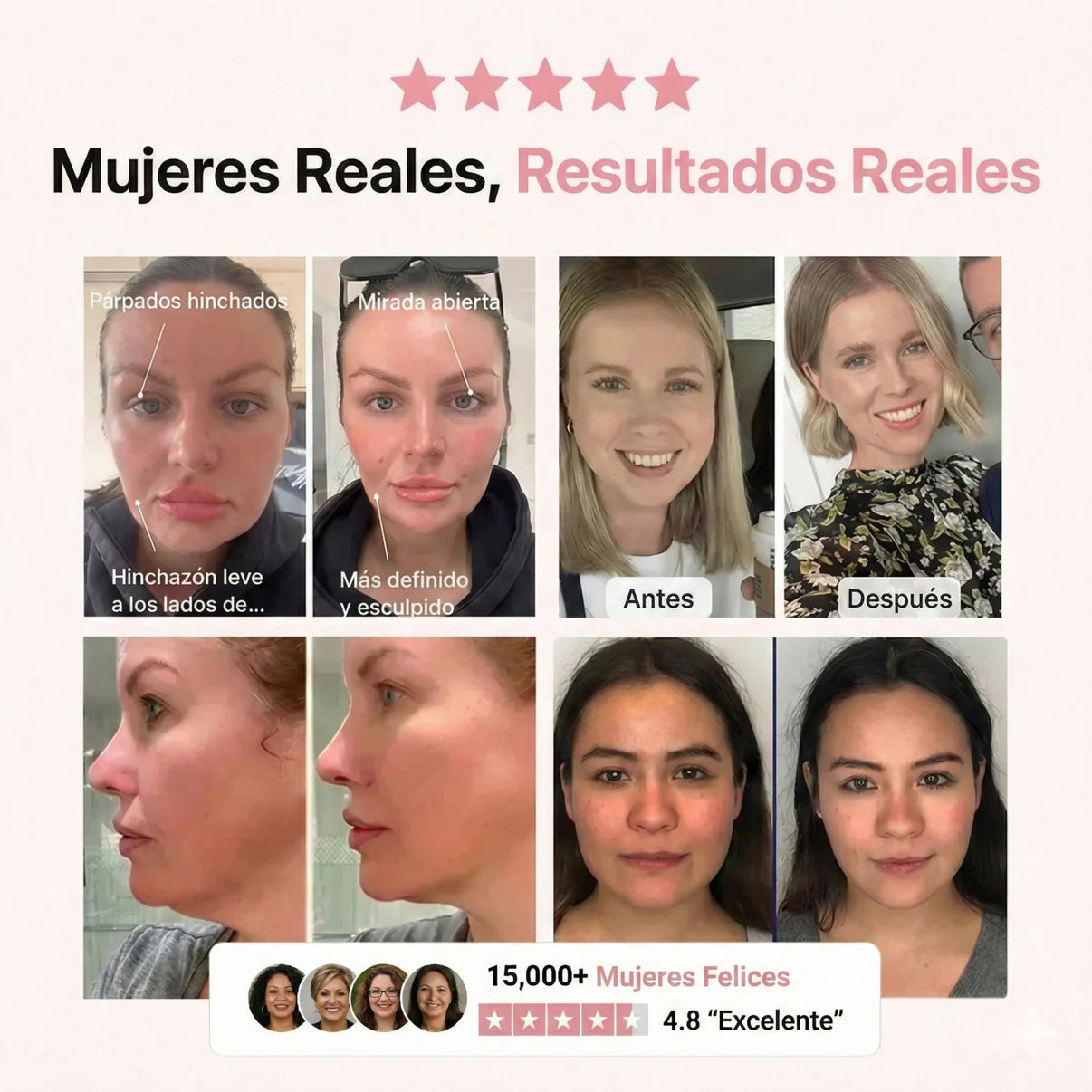 Crema Reafirmante CuelloLif