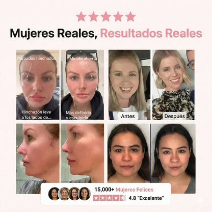 Crema Reafirmante CuelloLif